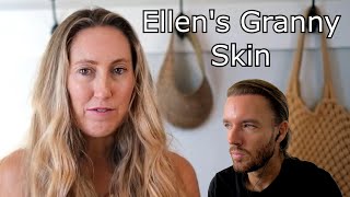 Ellen FIsher's Skin Care Products Are Not Helping Her Granny Skin @EllenFisher