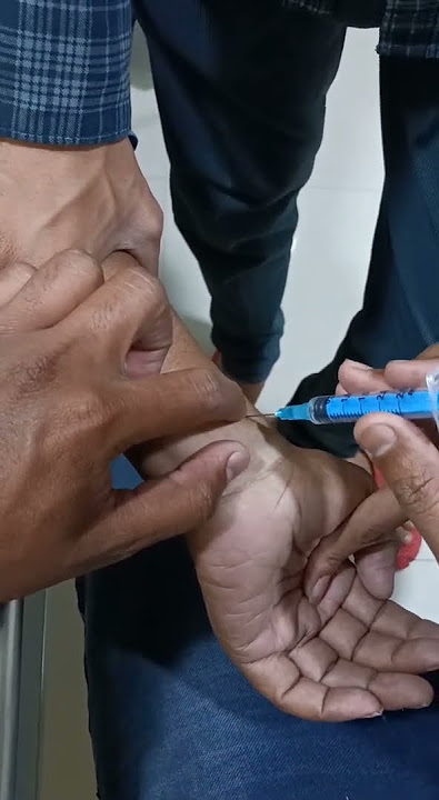 ABG sampling || Arterial blood sample kese le|| follow|| #medico #youtubeshorts #nature