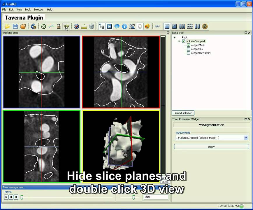 Execute Taverna Workflow in GIMIAS