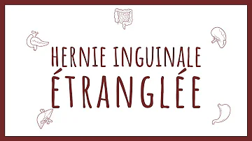 C'est quoi une hernie Etranglee ?