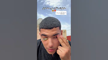 اويلي يا ويلي يا ويلي عندي غير عينة وحدة و خرجت عليها بهاد البوماضة الصفرا Shorts 