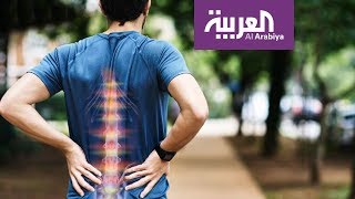 صباح العربية | نصائح لعلاج تحدب الظهر