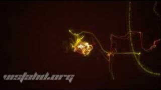 Light String - Dreamscene