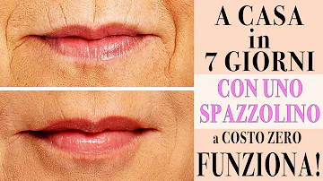 Come posso togliere il codice a barre sulle labbra?