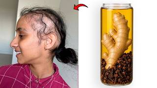 Nelken mit Ingwer mischen  🌿 das indische Geheimnis der Haarwuchs  und Kahlheitsbehandlung