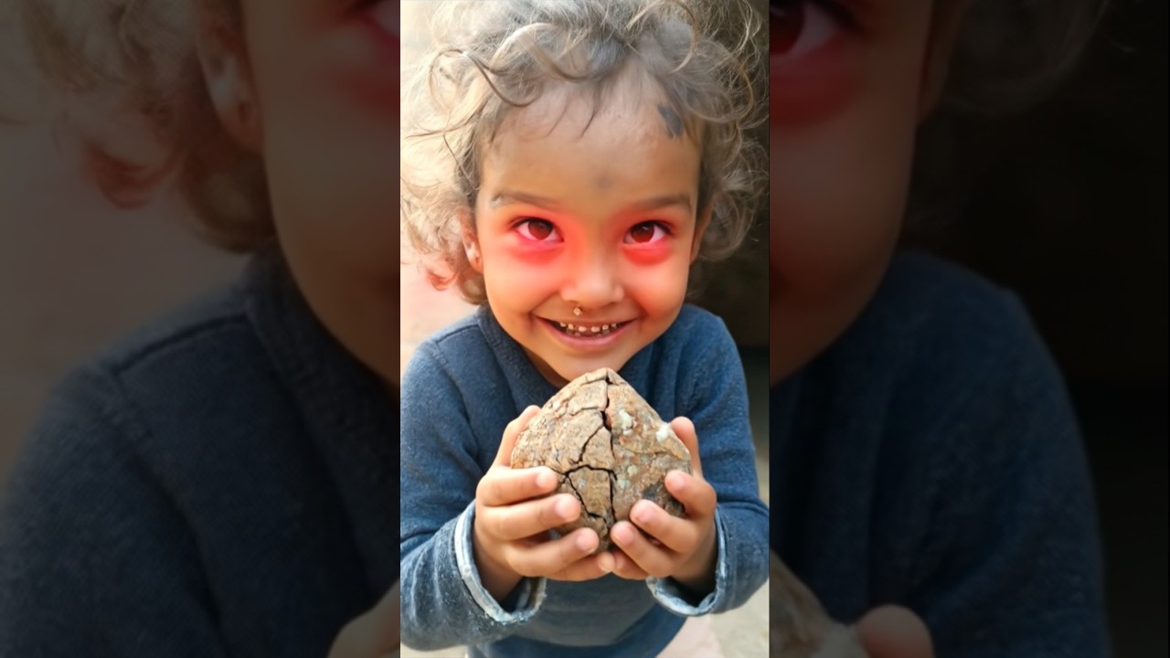 Just A Kid Normal Eye Editing Shorts 