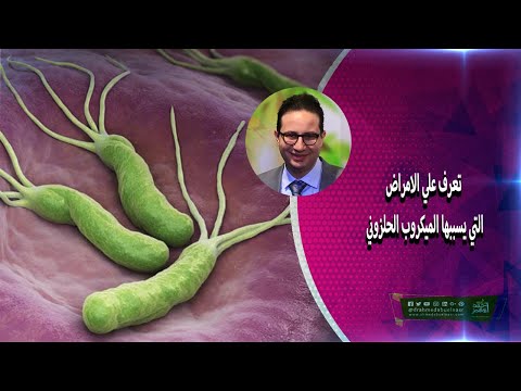تعرف علي الامراض التي يسببها الميكروب الحلزوني الدكتور أحمد أبو النصر