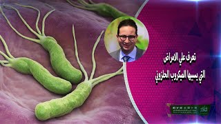 تعرف علي الامراض التي يسببها الميكروب الحلزوني - الدكتور أحمد أبو النصر