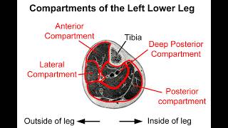Posterior Compartment Syndrome Q