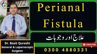 How Can Perennial And Fistula - Fistula - Laparoscopic Management Of Fistula And Abscess