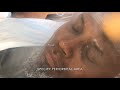 HYDROTHERMAL EYE GEL FACIAL TREATMENT Dr. Barber Chicago