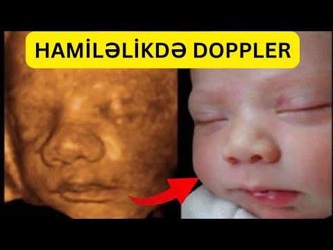 Video: Skanerlər nə vaxt populyarlaşdı?