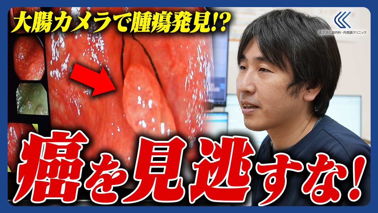 大腸 が ん 痔 違い