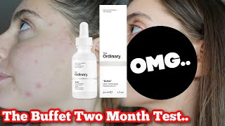 I TESTED THE ORDINARY BUFFET SERUM FOR 2 MONTHS.. OMG MY SKIN TRANSFORMED..