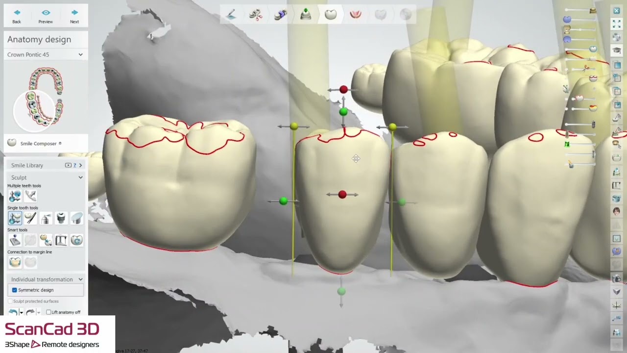 3shape 12-20-2025 ULAOX