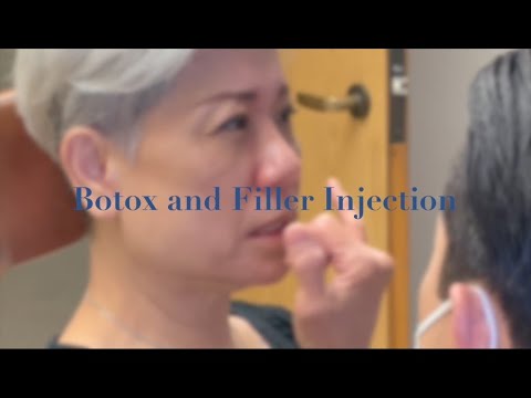 Demonstration of Botox & Filler Injections - YouTube