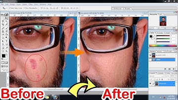 How to remove pimples from face in Adobe Photoshop 7.0