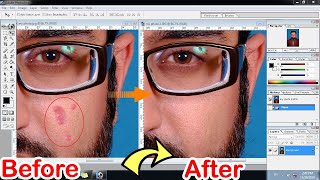 How to remove pimples from face in Adobe Photoshop 7.0