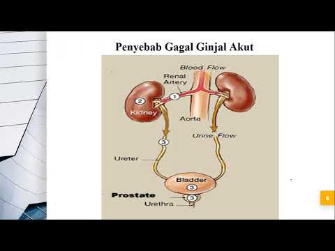 Video: Apa penyebab paling umum dari cedera ginjal akut?