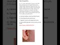 Medicine &amp; Surgery MCQs (For MBBS, USMLE, MCCQE &amp; PLAB)