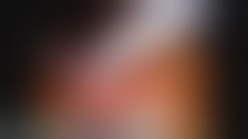 Francesco Porpiglia - Robotic Ureteral Ileal Replacement