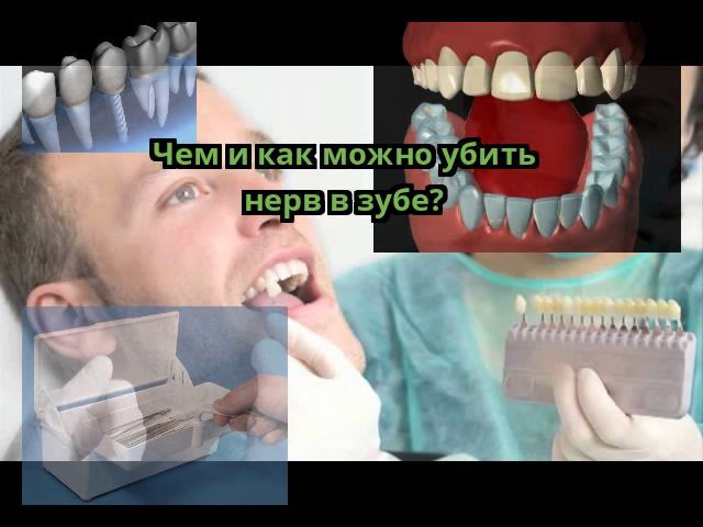 Чем и как можно убить нерв в зубе?
