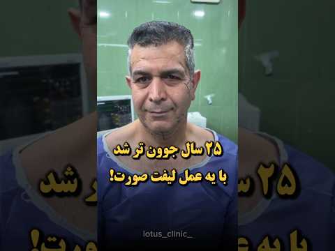 با یه عمل جراحی لیفت کامل صورت ۲۵ سال جوونتر شد