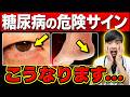 【放置危険】進行する前に知って欲しい『隠れ糖尿病』の初期症状･危険サイン７選【セルフチェック法を医師解説】
