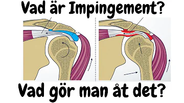 Hur vet jag mitt synfel?