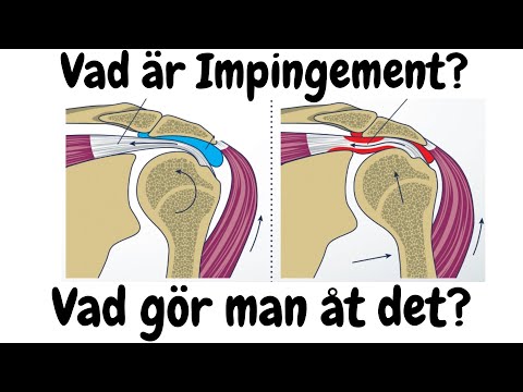 Vad är Impingement och vad gör man åt det?