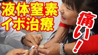痛い!液体窒素・イボ治療!【岡山キッズタレントsana(さな7歳)】 さな 検索動画7 痛い!液体窒素・イボ治療!【岡山キッズタレントsana(さな7歳)】 さな 検索動画 7