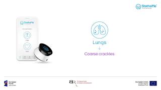 Lungs Auscultation - Coarse Crackles 