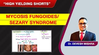 High Yielding Shorts-77 (#HYS-77):Mycosis fungoides/Sézary syndrome by Dr Devesh Mishra