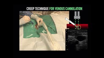 Ultrasound-Guided Central line tutorial