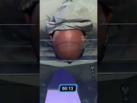 حماده هلال خسر من السقا في تحدي لأخر نفس