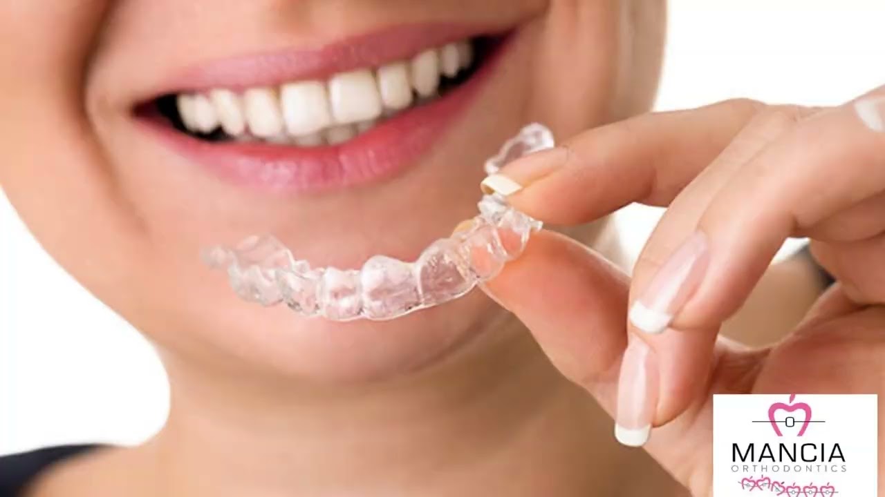 Mancia Orthodontics: Expert Invisalign Braces Treatment in Miami