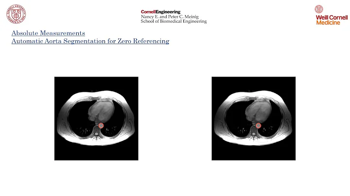 Ramin Jafari - Rapid automated liver quantitative ...