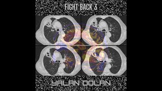 Still - Yalan Dolan [Instrumental]
