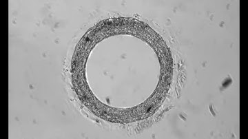 SmartHeart - Cardiac Organoid