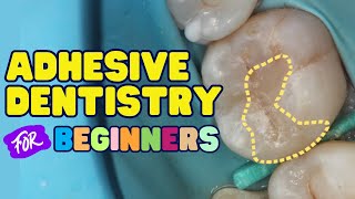 Adhesive Dentistry for Beginners  PS002
