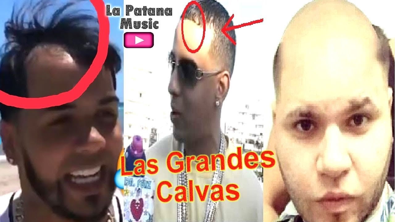 Artistas urbanos intentan esconder sus calvas