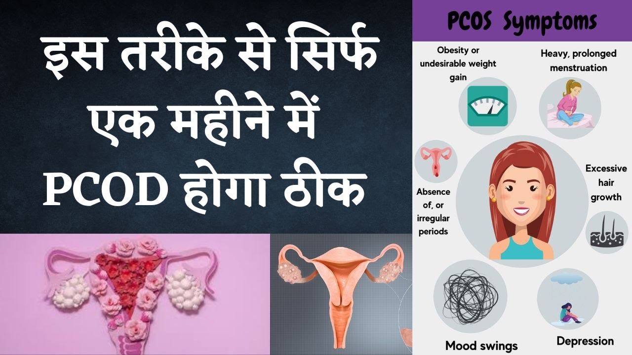 Cure PCOS PCOD Problem Permanently In 6 Steps 100 Guaranteed I DR Cure PCOS PCOD Problem Permanently In 6 Steps 100 Guaranteed I DR