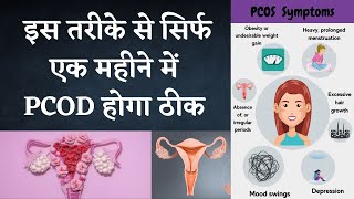Cure PCOS/PCOD Problem Permanently in 6 Steps (100% Guaranteed) I DR. MANOJ DAS