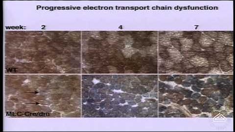 Mitochondria: dynamic organelles critical for human health