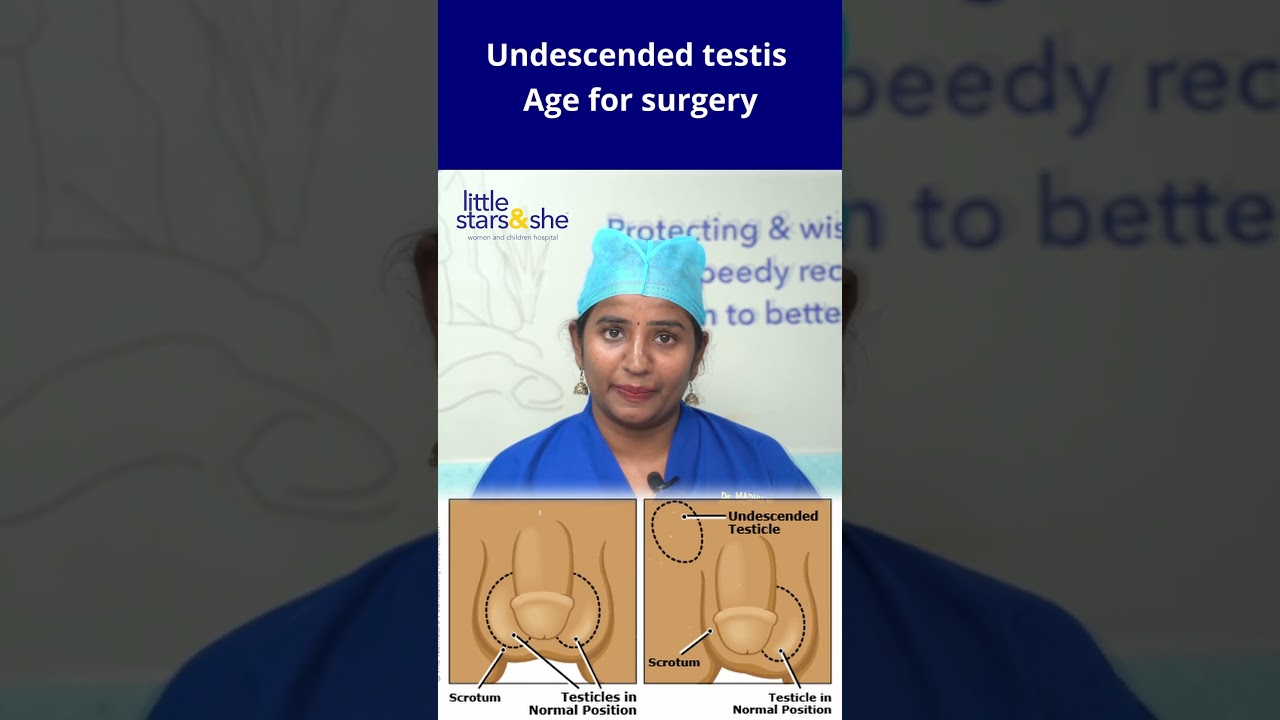 When is the Right Time for Surgery in Undescended Testicle Cases? Dr. Madhulika Provides Clarity