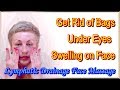 How to Get Rid of Bags Under Your Eyes and Swelling on Face / Lymphatic Drainage Face Massage