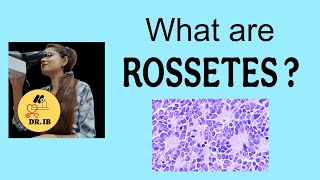 What Are Rossetes?