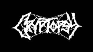 CRYPTOPSY -  open face surgery / phobophile