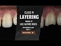 Class IV Layering: Build It Like Nature Does! Part 4