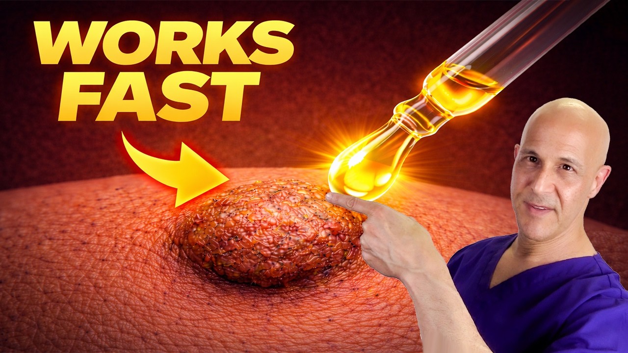 This Wart Won’t Go Away? Do This Every Day (Step-by-Step)